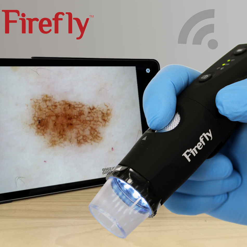 Dermatoscope Firefly